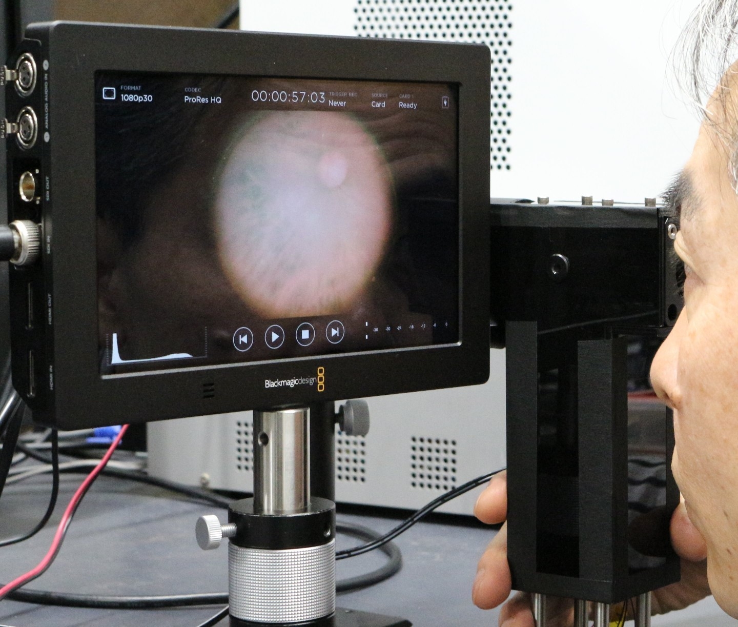 Miniaturized infrared cameras take colored photos of the eye