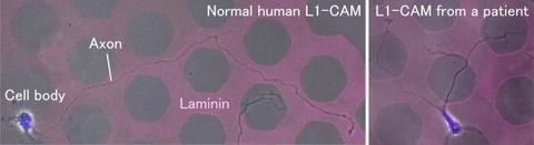 Axons grip and slip their way around the brain