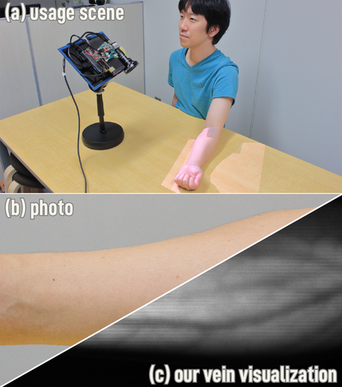 Looking inside the body with indirect light