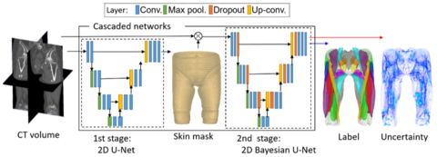 Artificial intelligence learns muscle anatomy in CT images